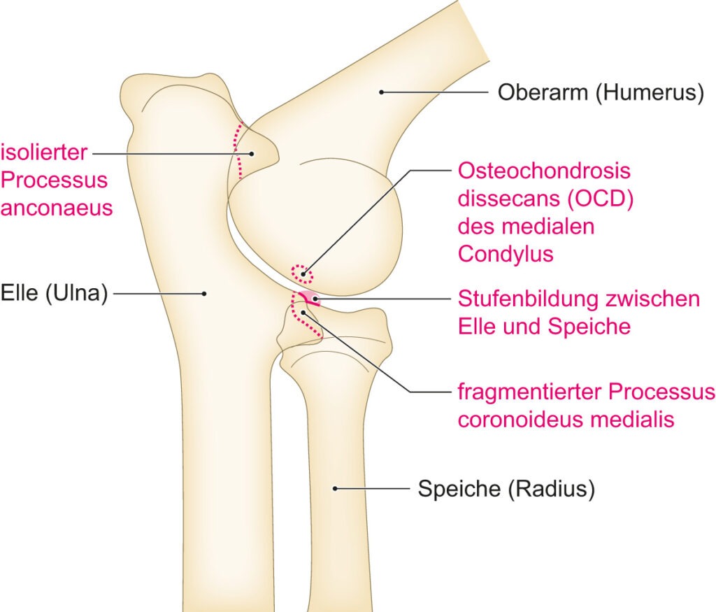 Ellbogendysplasie